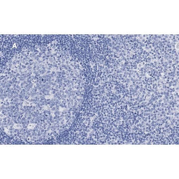 Anti-Calnexin Antibody, clone 10N19, ZooMAb® Rabbit Monoclonal，25UL，ZRB1147-25UL，Sigma
