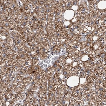 Anti-TNKS antibody produced in rabbit，100UL，HPA025690-100UL，Sigma