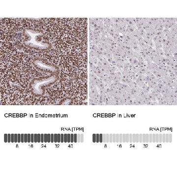 Anti-CREBBP antibody produced in rabbit，100UL，HPA055861-100UL，Sigma