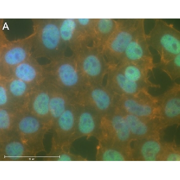Anti-p-IκBα-Ser32 Antibody, clone 11D19 ZooMAb® Rabbit Monoclonal，25UL，ZRB1554-25UL，Sigma