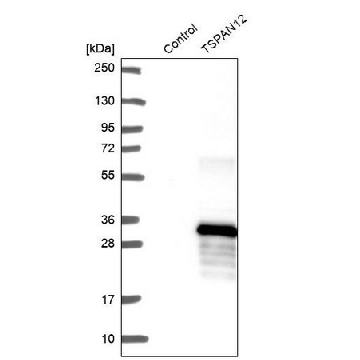 Anti-TSPAN12 antibody produced in rabbit，100UL，HPA058244-100UL，Sigma