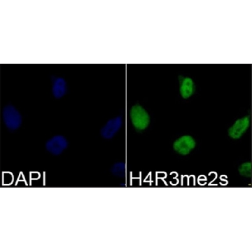 Anti-Histone H4R3me2s antibody produced in rabbit，100UL，SAB4300870-100UL，Sigma