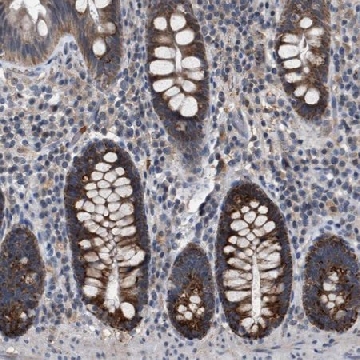 Anti-TECPR1 antibody produced in rabbit，100UL，HPA021061-100UL，Sigma