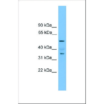 Anti-NOBOX antibody produced in rabbit，100UL，SAB2105362-100UL，Sigma