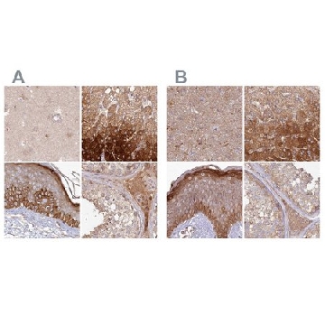 Anti-HAL antibody produced in rabbit，100UL，HPA038547-100UL，Sigma
