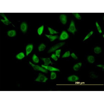 Anti-TRIM25 antibody produced in mouse，50UG，SAB1406620-50UG，Sigma