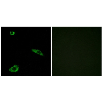 Anti-ACTHR antibody produced in rabbit，100UG，SAB4501839-100UG，Sigma