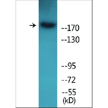 Anti-phospho-ALK (pTyr¹⁶⁰⁴) antibody produced in rabbit，100UG，SAB4504019-100UG，Sigma