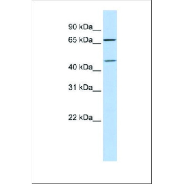 Anti-SLC5A7 antibody produced in rabbit，100UL，SAB2102221-100UL，Sigma