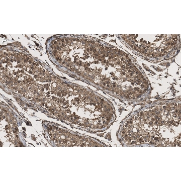 Anti-KLF5 Antibody, clone 1J12 ZooMAb® Rabbit Monoclonal，25UL，ZRB1194-25UL，Sigma