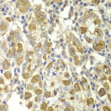 Anti-TNF-α antibody produced in rabbit，100UL，SAB5700698-100UL，Sigma