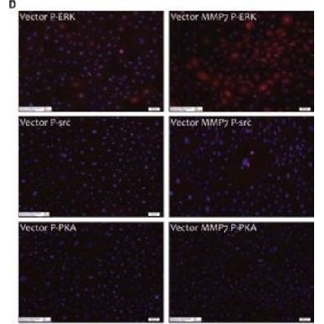 Anti-MMP-7 antibody produced in rabbit，100UG，SAB4501894-100UG，Sigma