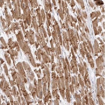Anti-TMEM65 antibody produced in rabbit，100UL，HPA025020-100UL，Sigma