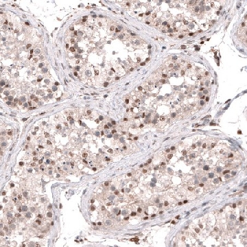 Anti-SMYD2 antibody produced in rabbit，100UL，HPA029023-100UL，Sigma
