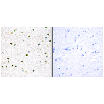 Anti-AKAP11 antibody produced in rabbit，100UG，SAB4500230-100UG，Sigma