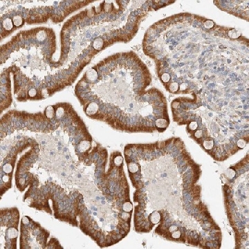 Anti-C12orf49 antibody produced in rabbit，100UL，HPA026905-100UL，Sigma