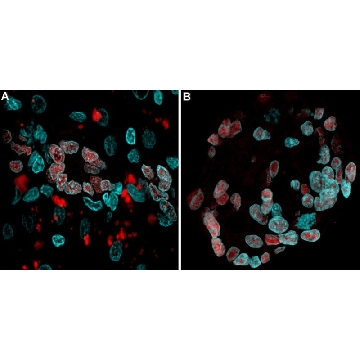 Anti-SOX-9 Antibody, clone 2B10, ZooMAb® Rabbit Monoclonal，4X25UL，ZRB5535-4X25UL，Sigma