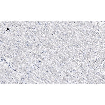 Anti-Connexin 43 Antibody, clone 5H23, ZooMAb® Rabbit Monoclonal，4X25UL，ZRB1179-4X25UL，Sigma