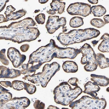 Anti-IL18R1 antibody produced in rabbit，100UL，HPA007615-100UL，Sigma