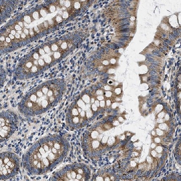Anti-SAMD4B antibody produced in rabbit，100UL，HPA016800-100UL，Sigma