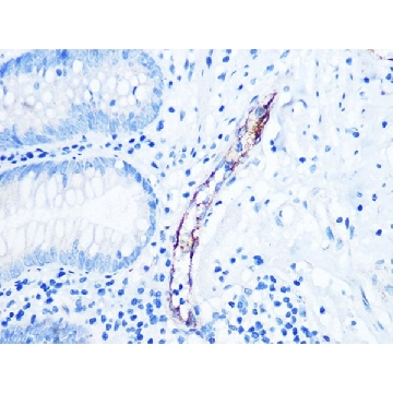 Anti-CD62P/P-selectin antibody produced in rabbit，100UL，SAB5701577-100UL，Sigma