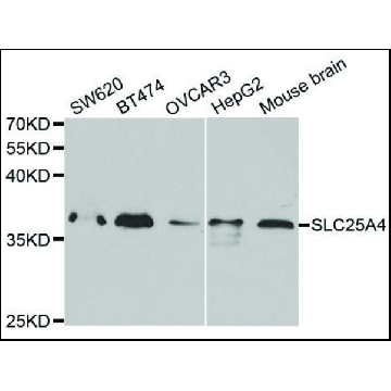 Anti-SLC25A4 antibody produced in rabbit，100UL，SAB4300887-100UL，Sigma