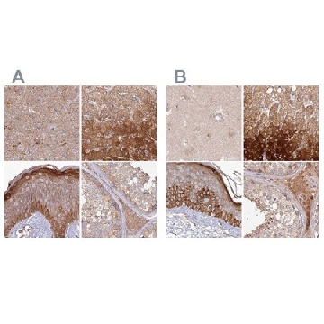 Anti-HAL antibody produced in rabbit，100UL，HPA038548-100UL，Sigma