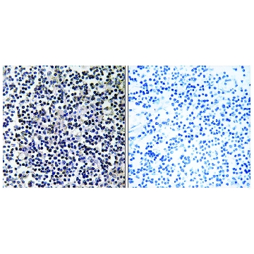Anti-TACC3 antibody produced in rabbit，100UG，SAB4500103-100UG，Sigma