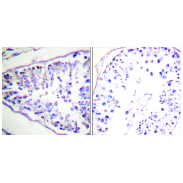 Anti-HSL antibody produced in rabbit，100UG，SAB4501763-100UG，Sigma