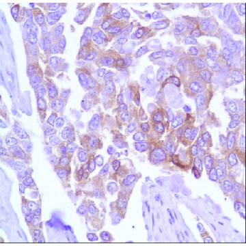 Anti-TAU antibody, Rabbit monoclonal，100UL，SAB5500182-100UL，Sigma