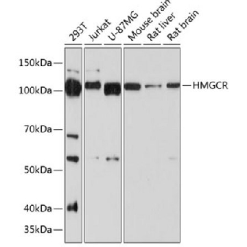 Anti-HMGCR Antibody, clone 6Y9L8, Rabbit Monoclonal，100UL，SAB5702098-100UL，Sigma