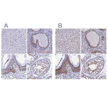 Anti-CCDC86 antibody produced in rabbit，100UL，HPA041117-100UL，Sigma
