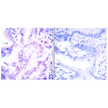 Anti-Thyroid Hormone Receptor β, N-Terminal antibody produced in rabbit，100UG，SAB4502969-100UG，Sigma