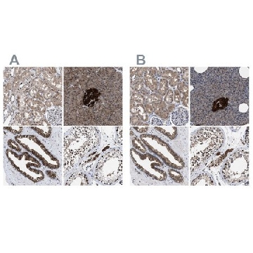 Anti-ACLY antibody produced in rabbit，100UL，HPA022434-100UL，Sigma