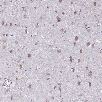 Anti-TMEM106B antibody produced in rabbit，100UL，HPA058342-100UL，Sigma