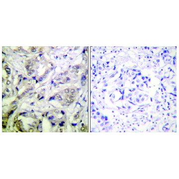 Anti-CAMK1-α antibody produced in rabbit，100UG，SAB4503409-100UG，Sigma