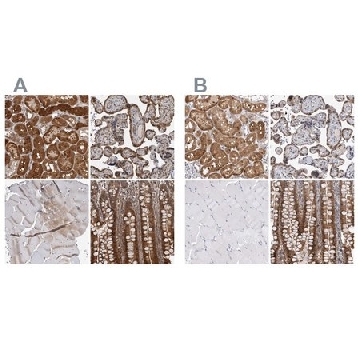 Anti-NAPRT antibody produced in rabbit，100UL，HPA023739-100UL，Sigma