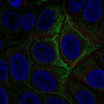 Anti-ADCY5 antibody produced in rabbit，100UL，HPA077682-100UL，Sigma