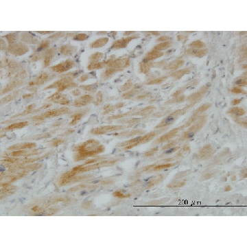 Monoclonal Anti-HHIP antibody produced in mouse，100UG，WH0064399M1-100UG，Sigma