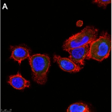 Anti-ALK-7 Antibody, clone 1N5 ZooMAb® Rabbit Monoclonal，25UL，ZRB1384-25UL，Sigma
