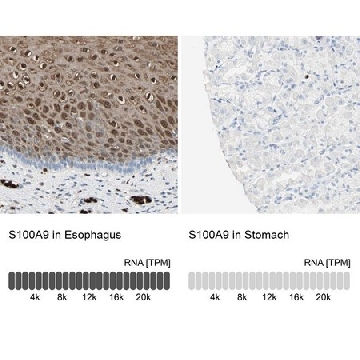 Anti-S100A9 antibody produced in rabbit，100UL，HPA004193-100UL，Sigma