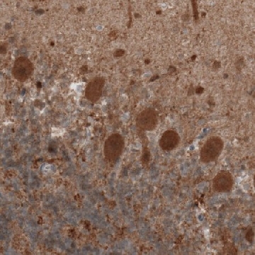 Monoclonal Anti-UCHL1 antibody produced in mouse，100UL，AMAB91145-100UL，Sigma