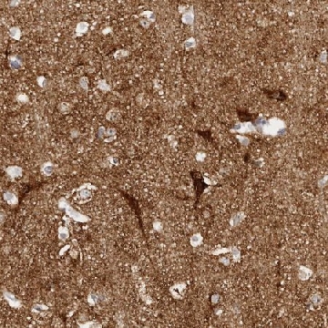 Anti-SLC25A22 antibody produced in rabbit，100UL，HPA014662-100UL，Sigma