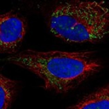 Anti-BCKDHB antibody produced in rabbit，100UL，HPA031956-100UL，Sigma