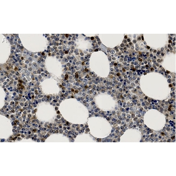 Anti-p38α/SAPK2A Antibody, clone 1O11 ZooMAb® Rabbit Monoclonal，4X25UL，ZRB1418-4X25UL，Sigma
