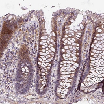 Anti-RNF170 antibody produced in rabbit，100UL，HPA054621-100UL，Sigma