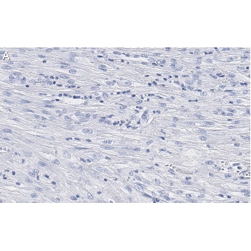Anti-β-Actin Antibody, clone 6L12, ZooMAb® Rabbit Monoclonal，4X25UL，ZRB1312-4X25UL，Sigma