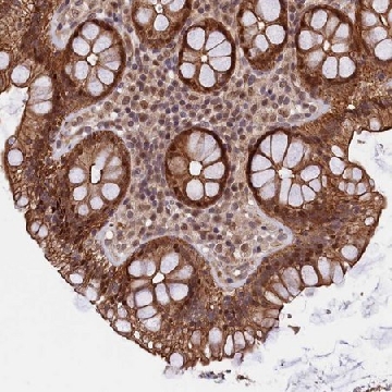 Anti-ARL14EP antibody produced in rabbit，100UL，HPA039634-100UL，Sigma