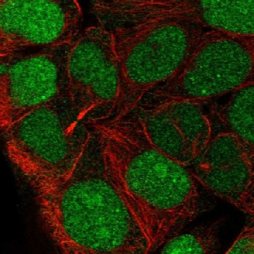 Anti-CCDC84 antibody produced in rabbit，100UL，HPA071715-100UL，Sigma