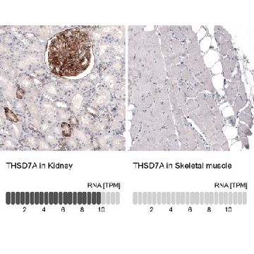 单克隆抗-THSD7A 小鼠抗，100UL，AMAB91233-100UL，Sigma